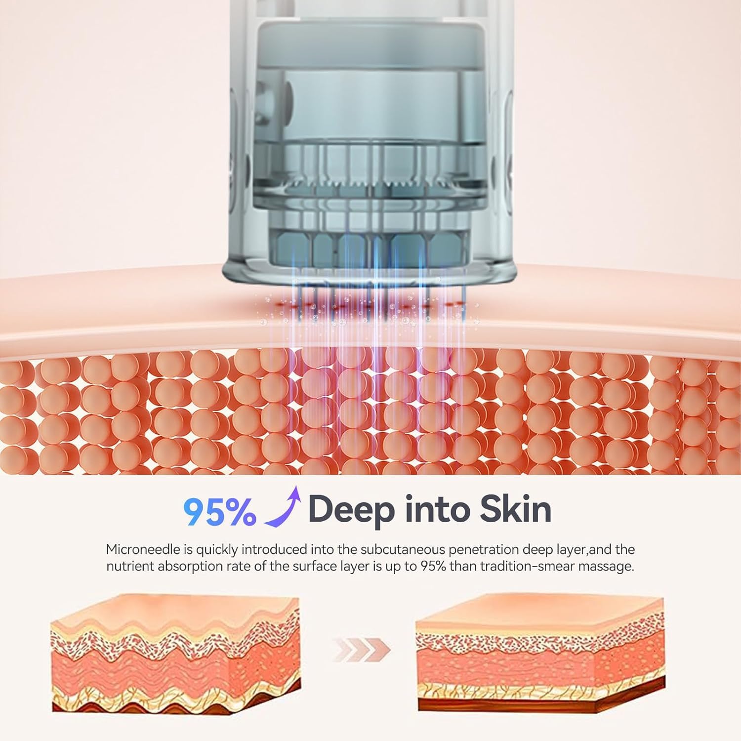 20pcs Nano Replacement Cartridges, Multiple Dermapen Microneedling Cartridges - Image 2