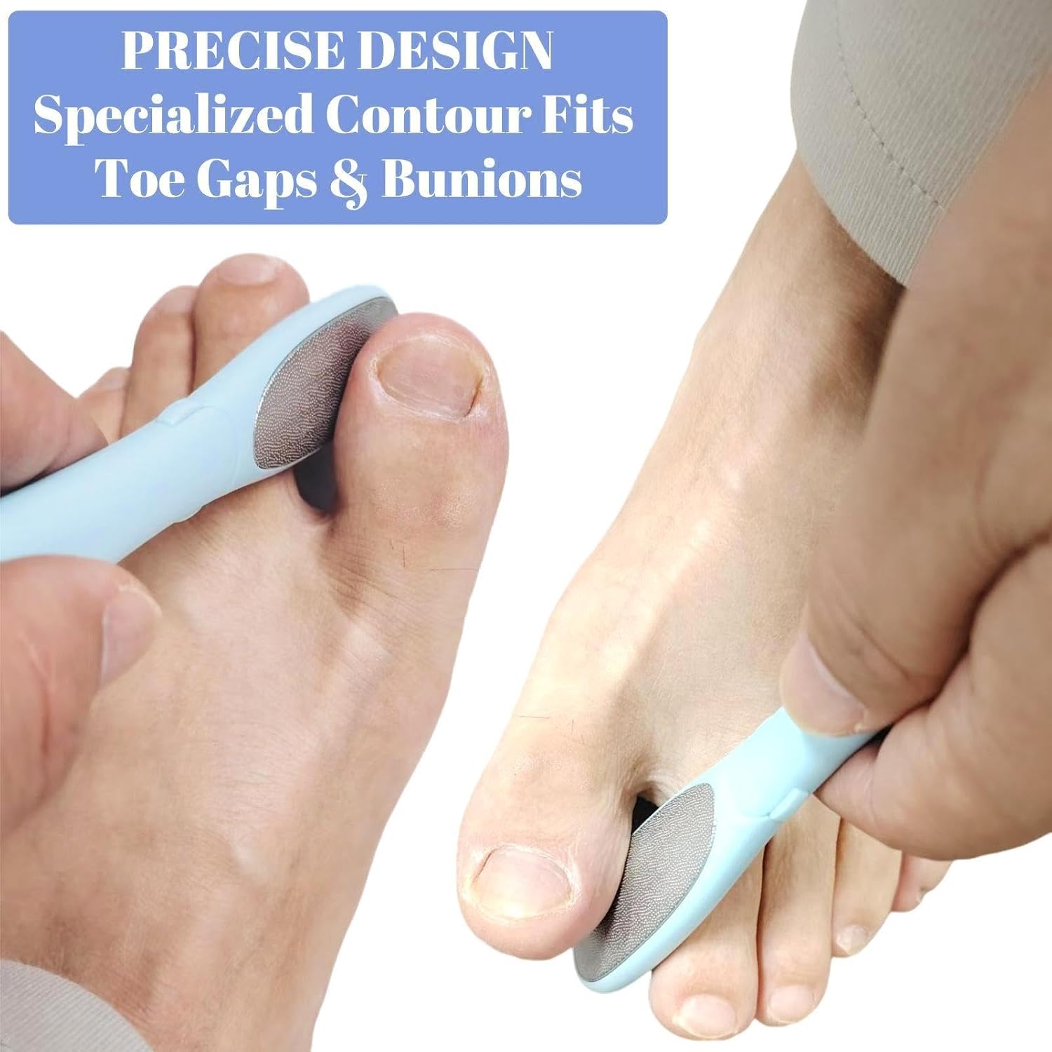 Precision Callus Remover and Bunion Scrubber, Detachable 2 in 1 Mini Travel Foot File Exfoliator for Toe Gaps, Hard Skin, Corns, Pedicures, Double-Sided Toenail File