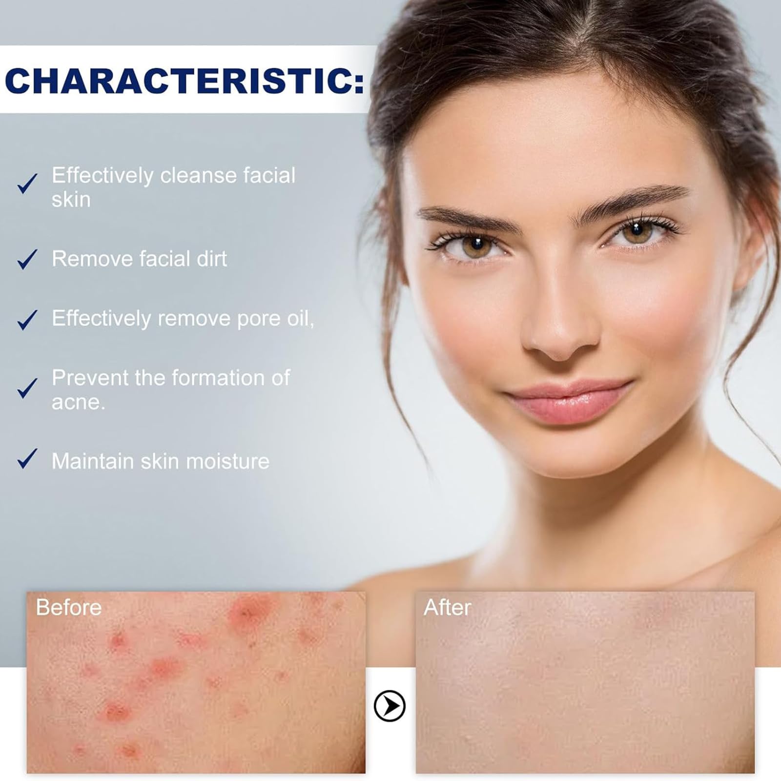 Acne Clean Foam Cleanser,Scuma Detergente Anti-Acne,Pulizia Profonda Dei Pori,Detergente Facciale E Corporeo,Deep Pore Cleansing Foam for Face Cleansing, Against Makeup