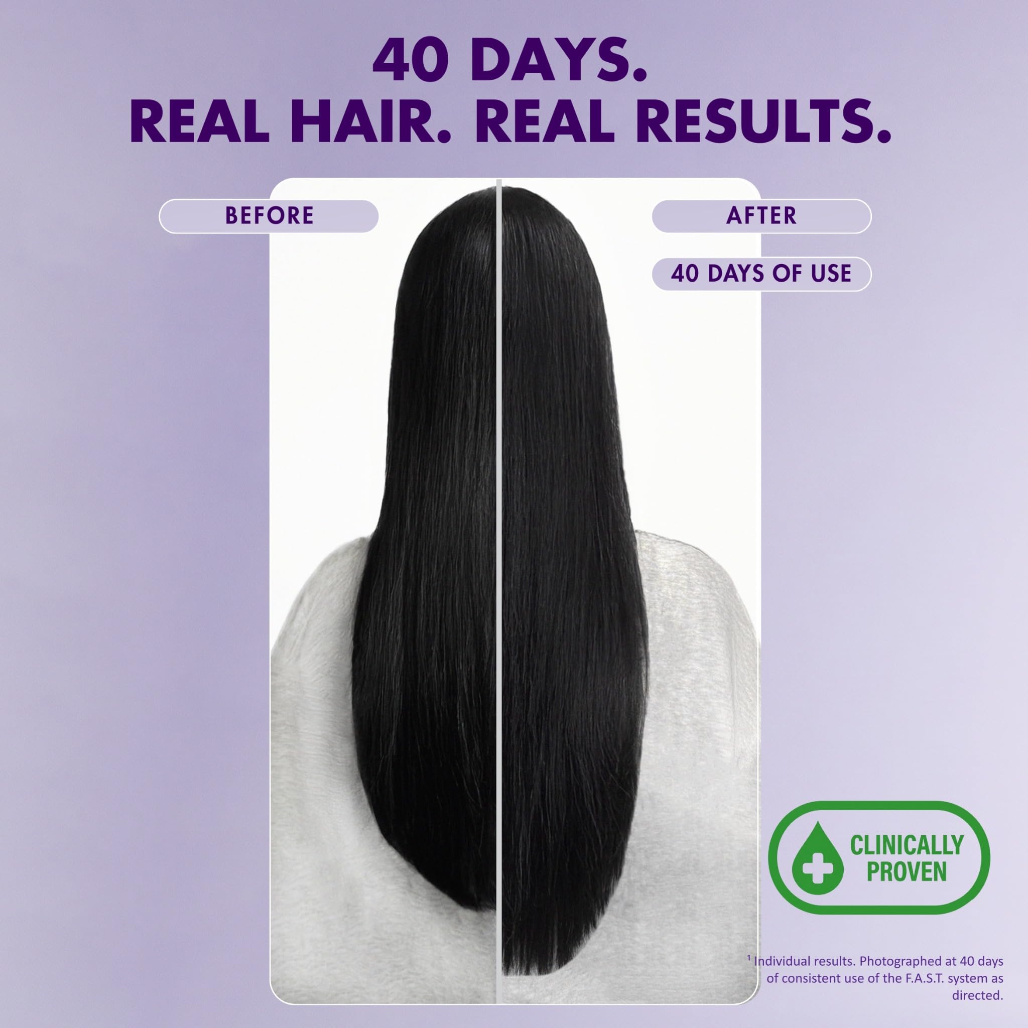 Nisim F.A.S.T. Hair Growth Shampoo with AVP Complex, Biotin & Niacinamide