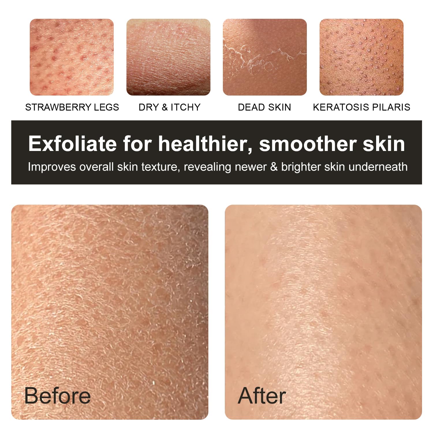 Exfoliating Glove, Korean Exfoliating Mitt Body Scrubber Exfoliator, 3 Pack Viscose Fiber Bath Shower Scrub Gloves, Dead Skin Remover for Body, Smoother Skin and Self-Tan Removal & Prep - Image 4