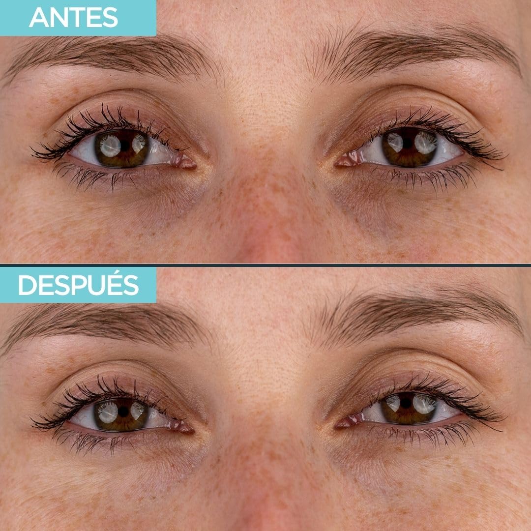 Parches Ojos Antiojeras Ácido Hialuronico - Crema Contorno de Ojos Antiarrugas + 2 Parches para Bolsas y Ojeras Reutilizables - Crema Ácido Hialuronico con Cafeina y Eye Patches