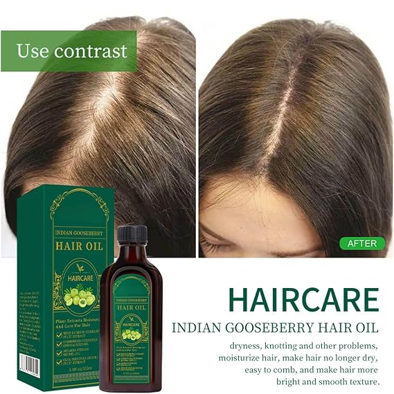 Amla Hair Oil Nourishing Natural Alma Oils for Hairs Growth, Indian Hair Growth Oil Herbal Oils for Volume, Shine, Hydration, Strengthen Roots, Reduce Fall, Moisturizing Scalp Care