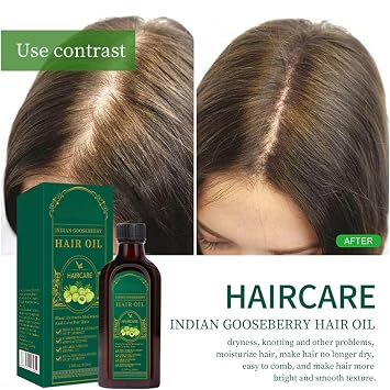 Amla Hair Oil Nourishing Natural Alma Oils for Hairs Growth, Indian Hair Growth Oil Herbal Oils for Volume, Shine, Hydration, Strengthen Roots, Reduce Fall, Moisturizing Scalp Care