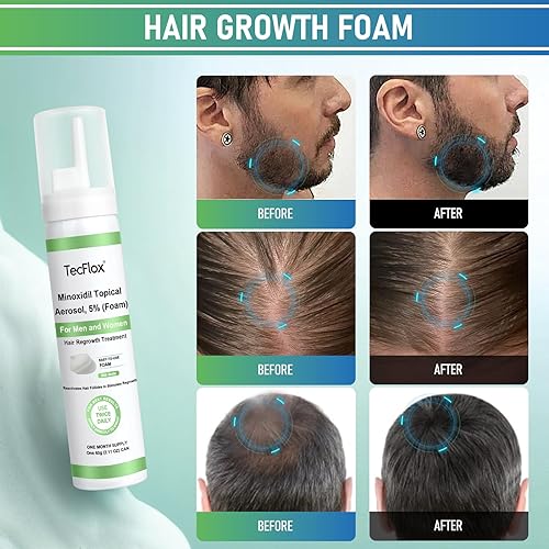 Miniatura 4 de Minoxidil Foam - 5% de mininoxidil para hombres y mujeres, crecimiento del cabello y la barba con biotina, cabello más grueso, sin perfume, 3 x 2.11