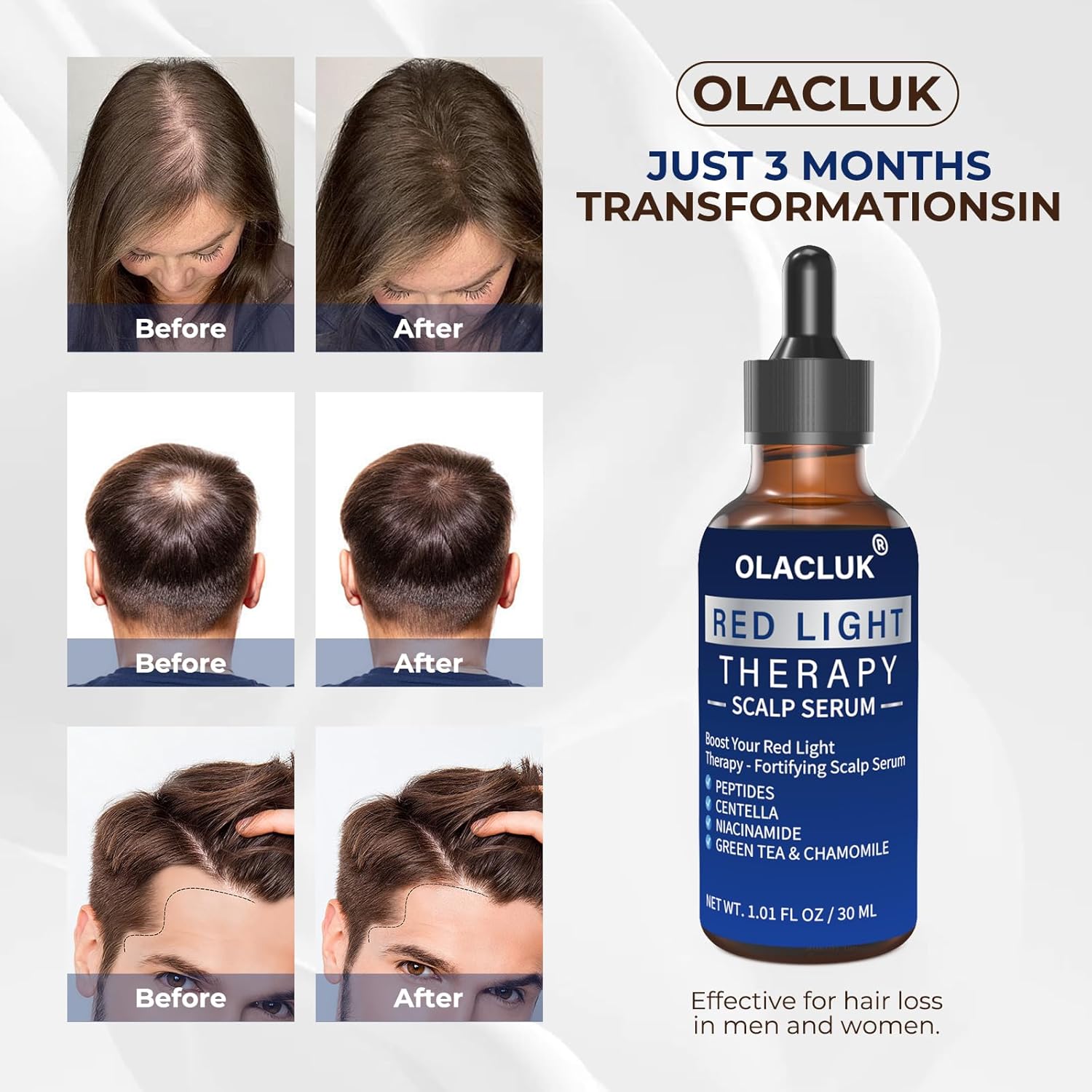 Red Light Therapy for Hair Growth Serum - Copper Peptide Scalp Serum Compatible with Red Light Cap Device- Promotes Thicker, Fuller, Stronger, Healthier Hair, Sutiable for All Type - 1 Oz