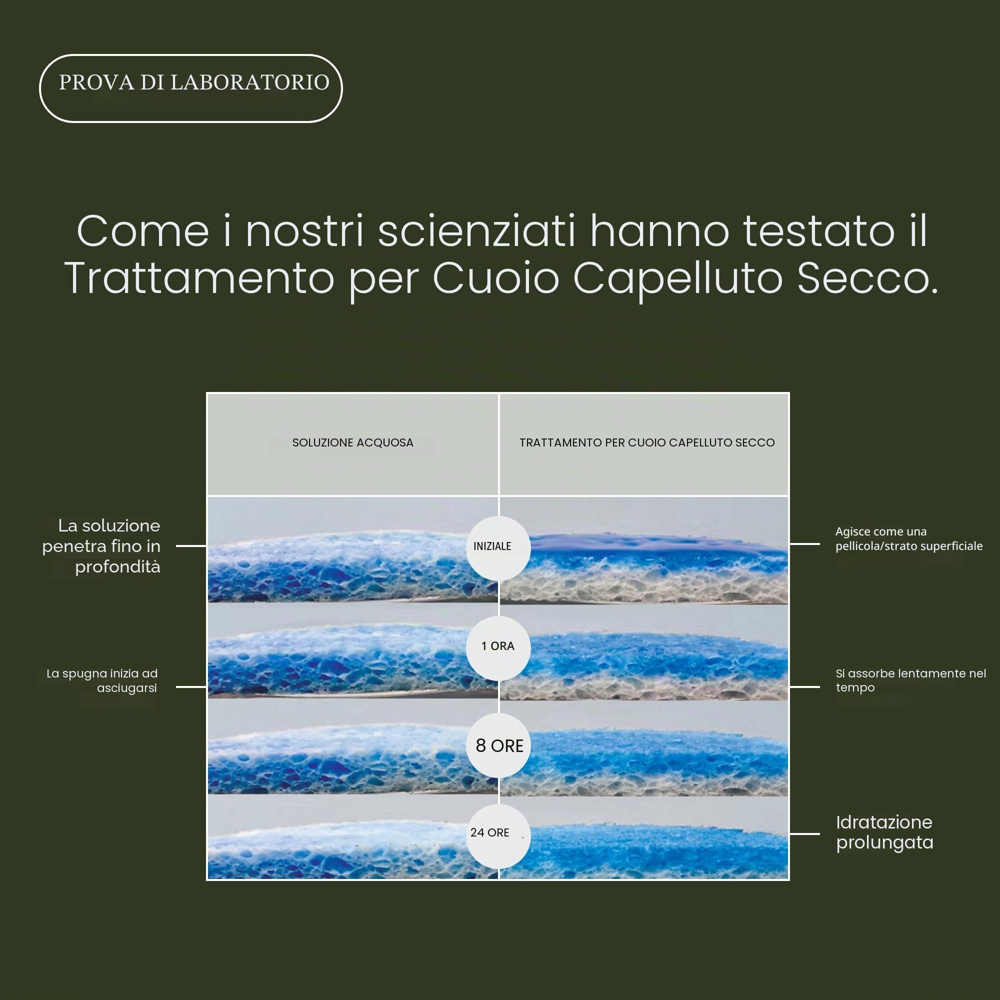 Living Proof Scalp Care Dry Scalp Treatment | Concentrato idratante per il cuoio capelluto secco | Lenisce, allevia la forfora e il prurito | Vegano, senza parabeni, siliconi, solfati | 100ml