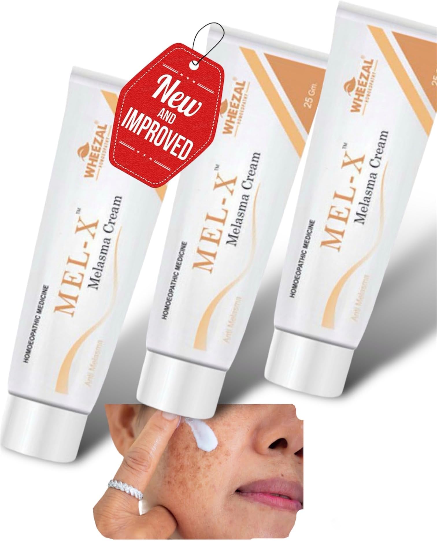 KRIG's Wheezal Mel X Melasma Cream - Set Of 3 Cream