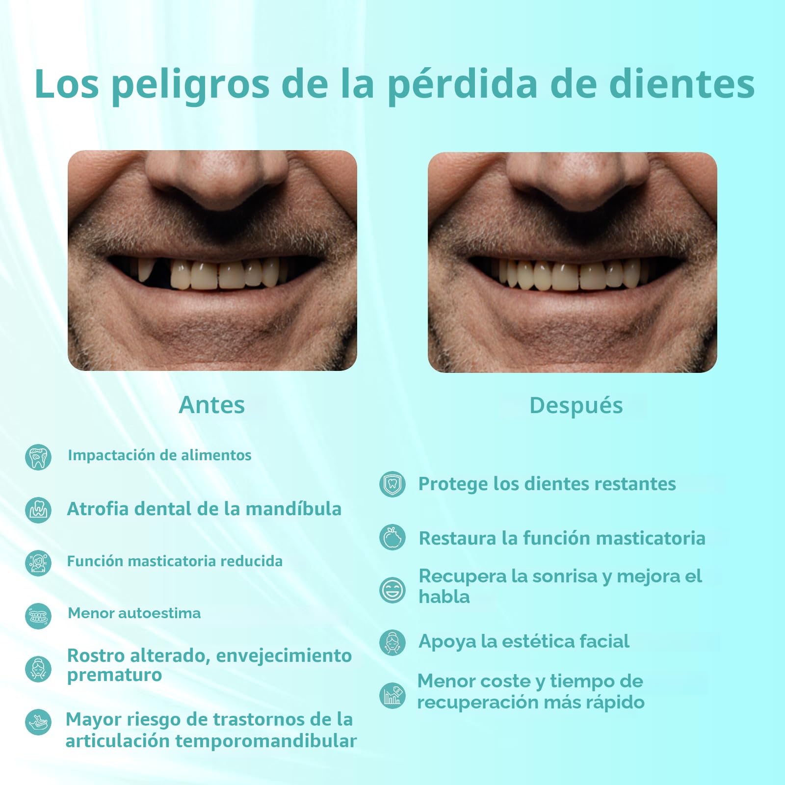 Prótesis parcial personalizada para espacios dentales – Prótesis dental provisional extraíble para hombres y mujeres, dentadura con ajuste perfecto. Fácil de usar para una sonrisa perfecta (1 diente)