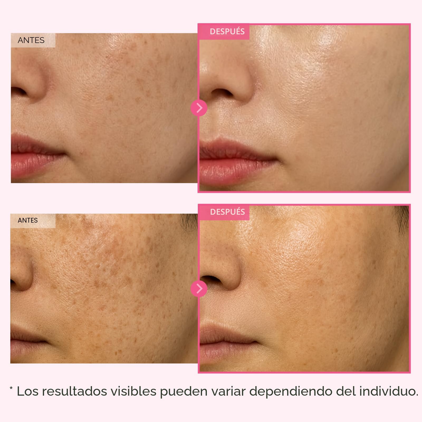 how to use glutathione cream Glutathione for the skin