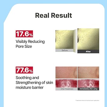 Illiyoon Ceramide Ato Concentrate Gel Face Mask | 34g x 4ea, Ceramide & Collagen Hydrating Overnight Hydrogel Mask with Hyaluronic Acid, Korean Pore Tightening Sleep Mask, Glass Skin Glow