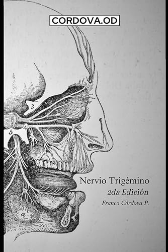 Nervio Trigémino