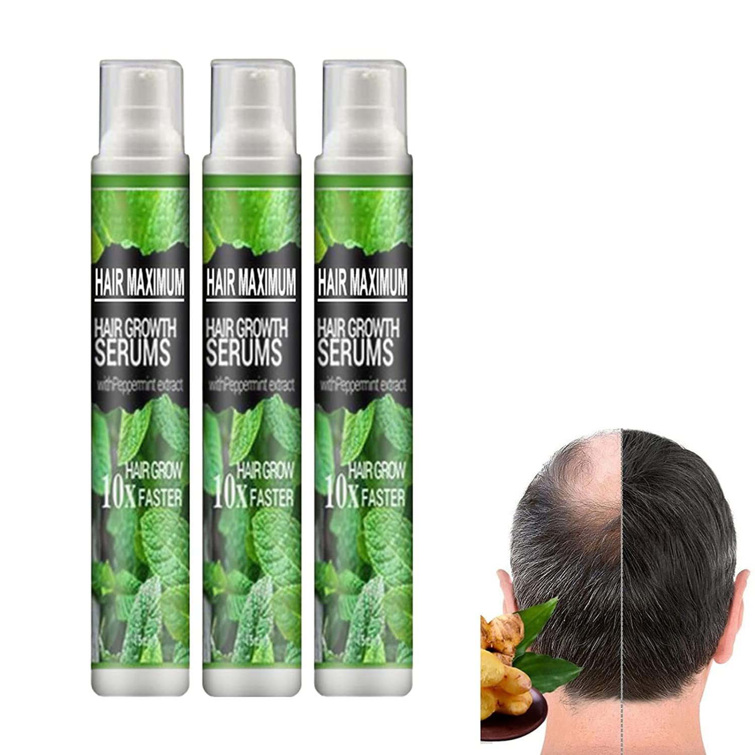 Buy HairReBirth al Spray, alRevive HairGrowth Essence Spray, Hair