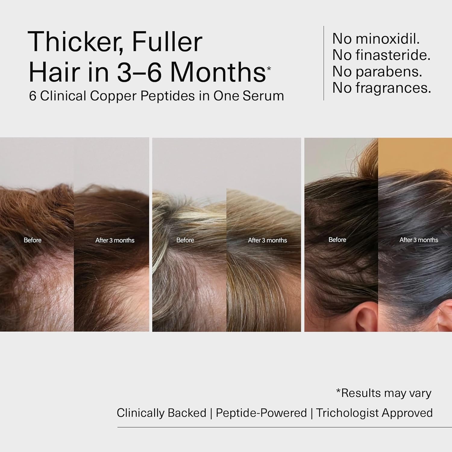 Bloom Clinically Proven Copper GHK-CU Peptide Hair Serum for Hair Growth - Non-Greasy & Lightweight Advanced Multi Copper Peptides for Thinning Hair - Made in USA - 3-Pack for 3 Months Supply