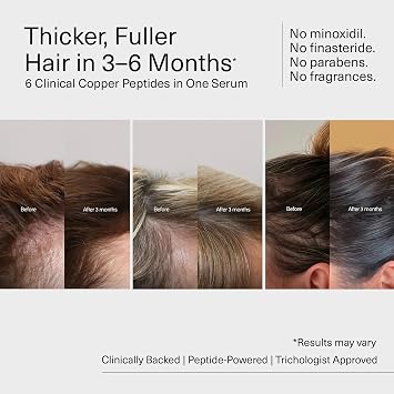 Bloom Clinically Proven Copper GHK-CU Peptide Hair Serum for Hair Growth - Multi Copper Peptides Non-Greasy & Lightweight for Thinning Hair - Promotes Fullness, Reduces Shedding - Made in USA