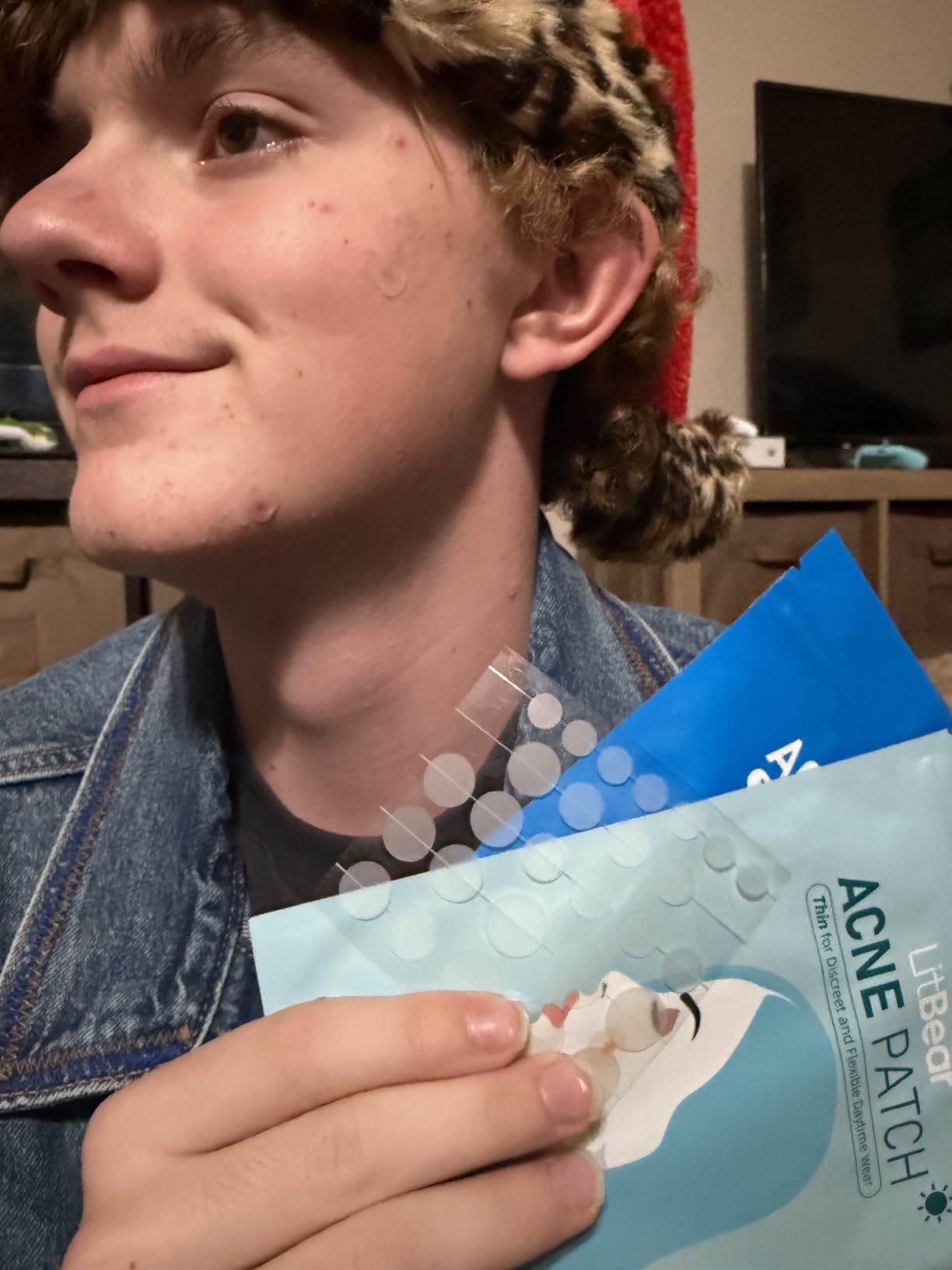 LitBear Acne Pimple Patches- Day and Night 4 Sizes 588 Dots Thin & Thick Hydrocolloid Patches with Witch Hazel, Tea Tree & Calendula Oil, Extra Adhesion for Face Zit Patch Dots 210pcs