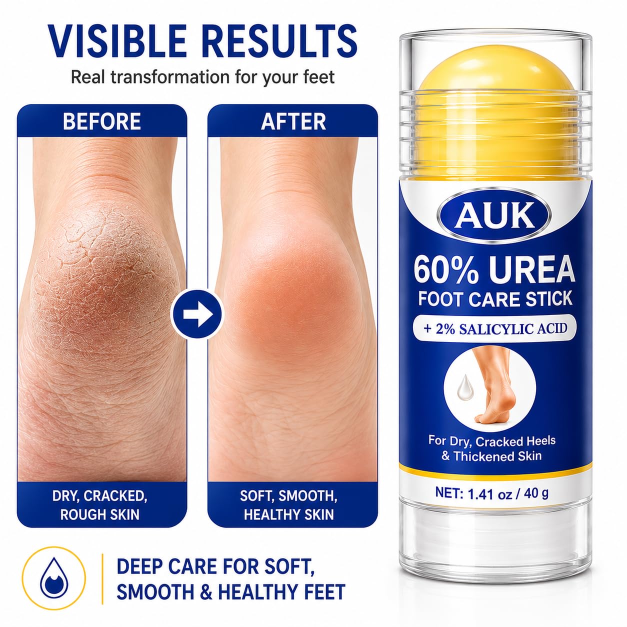 AUK 60% Urea Foot Care Stick with 2% Salicylic Acid, Moisturizing Foot Balm for Dry Cracked Heels, Rough Thickened Skin & Callused Feet, Targeted Stick for Feet Care, 1.41 oz