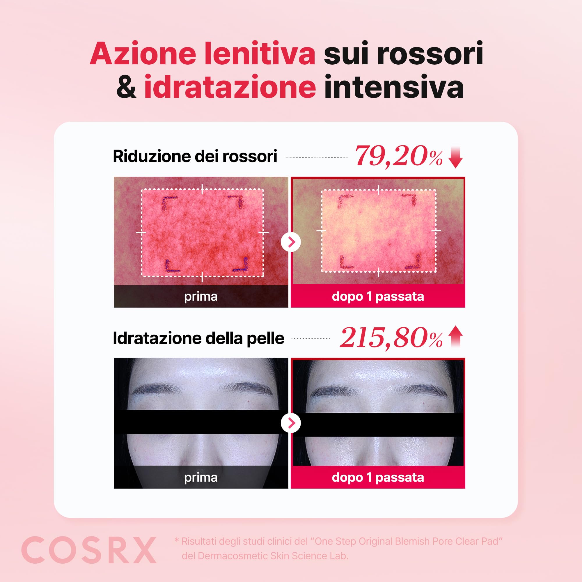 COSRX OneStep Original Blemish Pore Clear Pad, 100 cialde, Dual side Face Pad for Exfoliation, Pore Care & Idration with BHA, PHA & Zinc PCA & 5 Acidi ialuronici, coreano Skin Care
