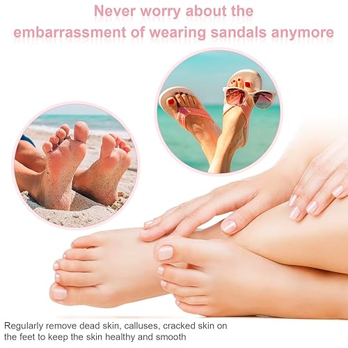 Miniatura 6 de 120 discos de papel de lija de repuesto para lima eléctrica de pie, herramienta de eliminación de callos de velocidad ajustable, discos de