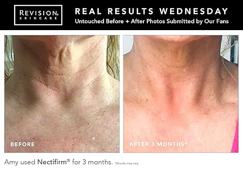 Miniatura 4 de Revisión Skincare necitfirm Tubo 8oz