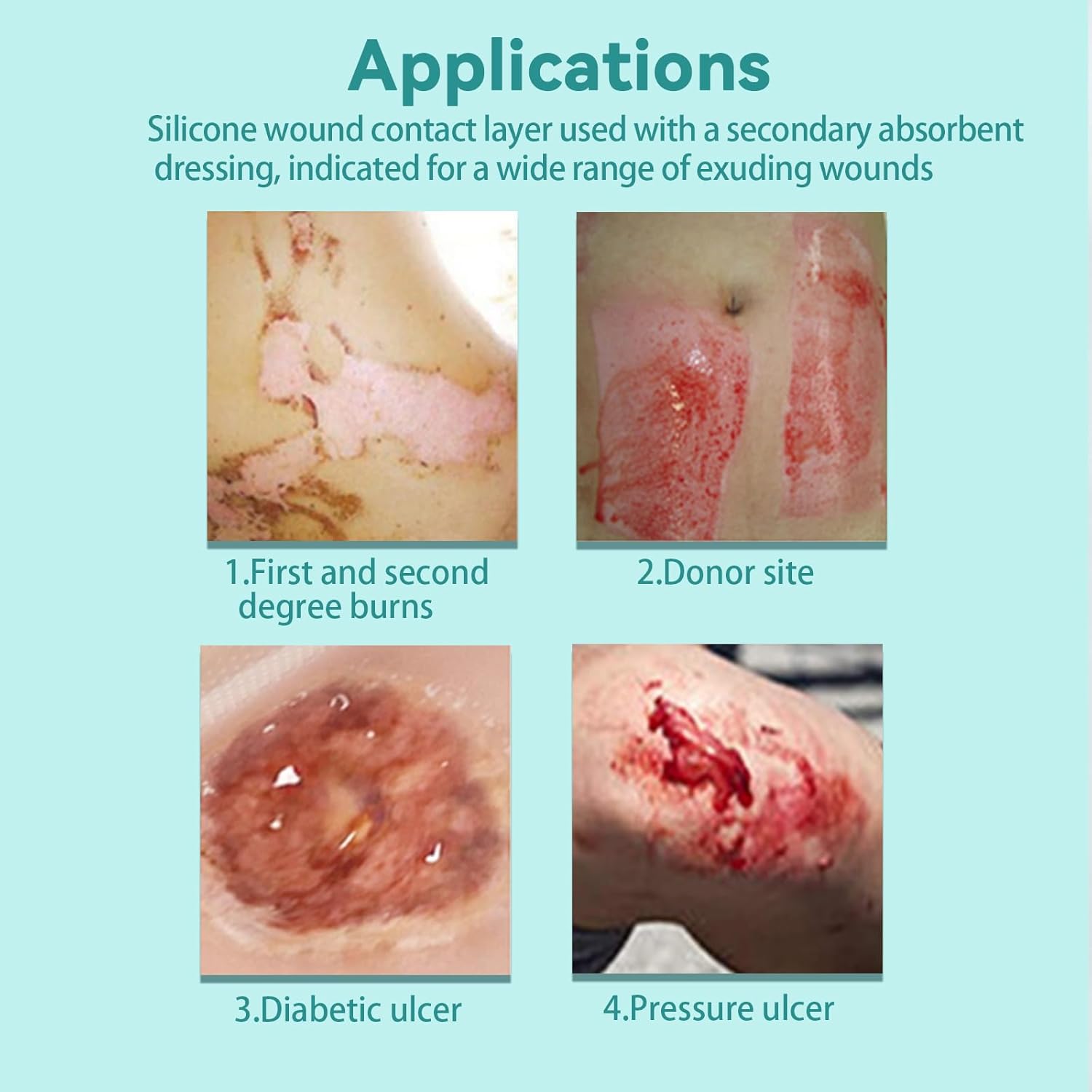 Dimora Silicone Wound Contact Layer, Non-adhering Dressing, Transparent Wound Dressing Pads, 3in x 4in (7.5cm x 10cm), 10 pcs - Image 6