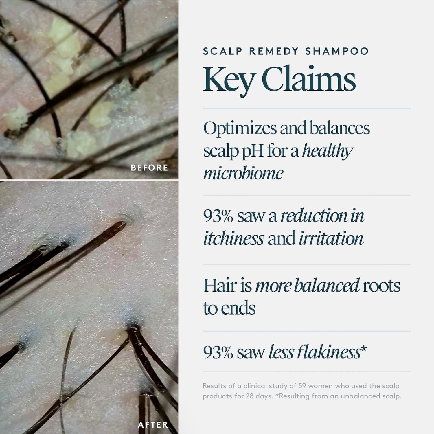 VIRTUE Scalp Remedy Shampoo, Microbiome Balancing for Dry, Oily, and Irritated Scalps, Fragrance Free, Safe for All Hair Types, Color Safe, 8 Fl Oz - Image 5