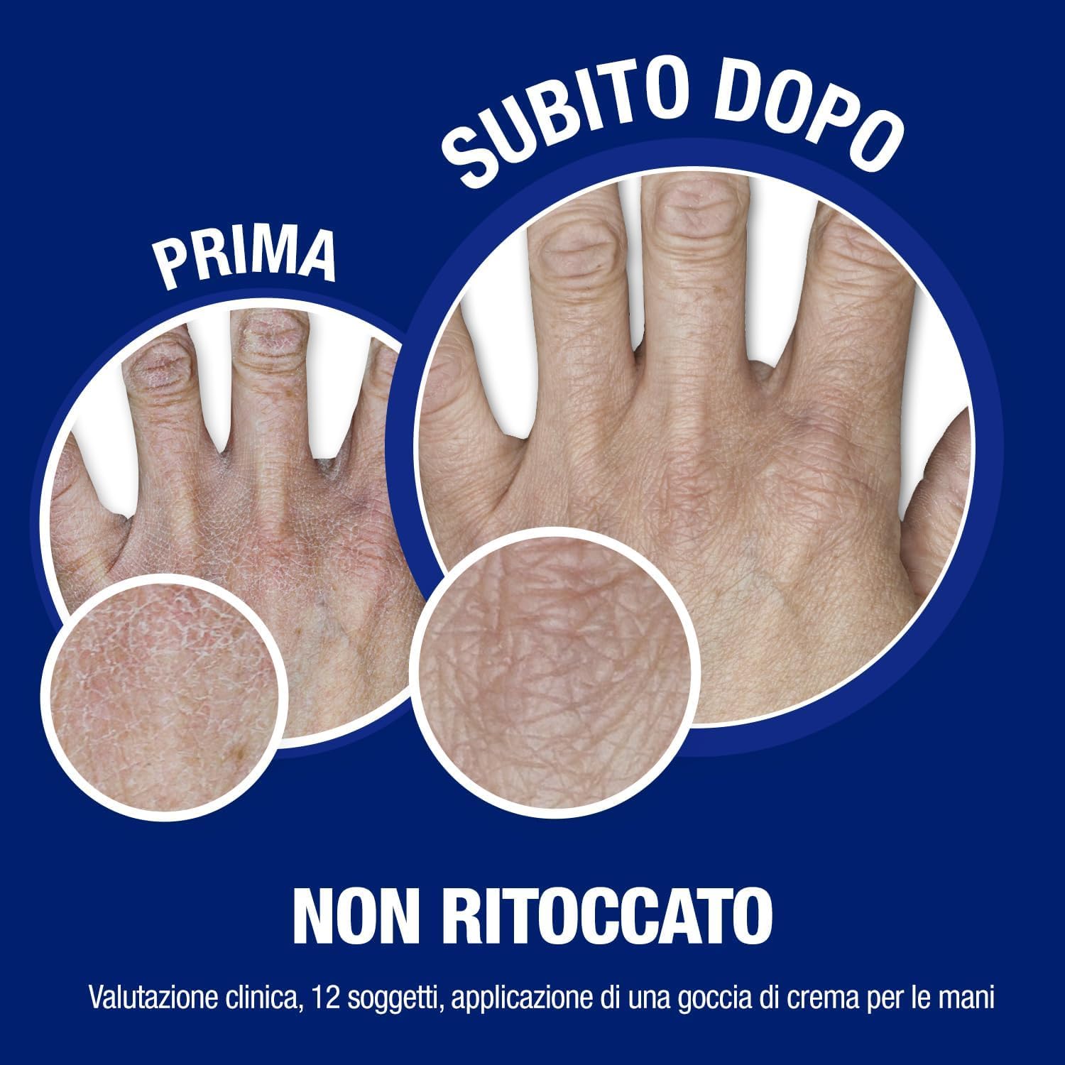 Neutrogena Formula Norvegese Crema Mani Assorbimento Rapido, Crema mani riparatrice con Glicerina e Vitamina E, Crema mani secche e screpolate dalla texture leggera ad assorbimento rapido, 75 ml