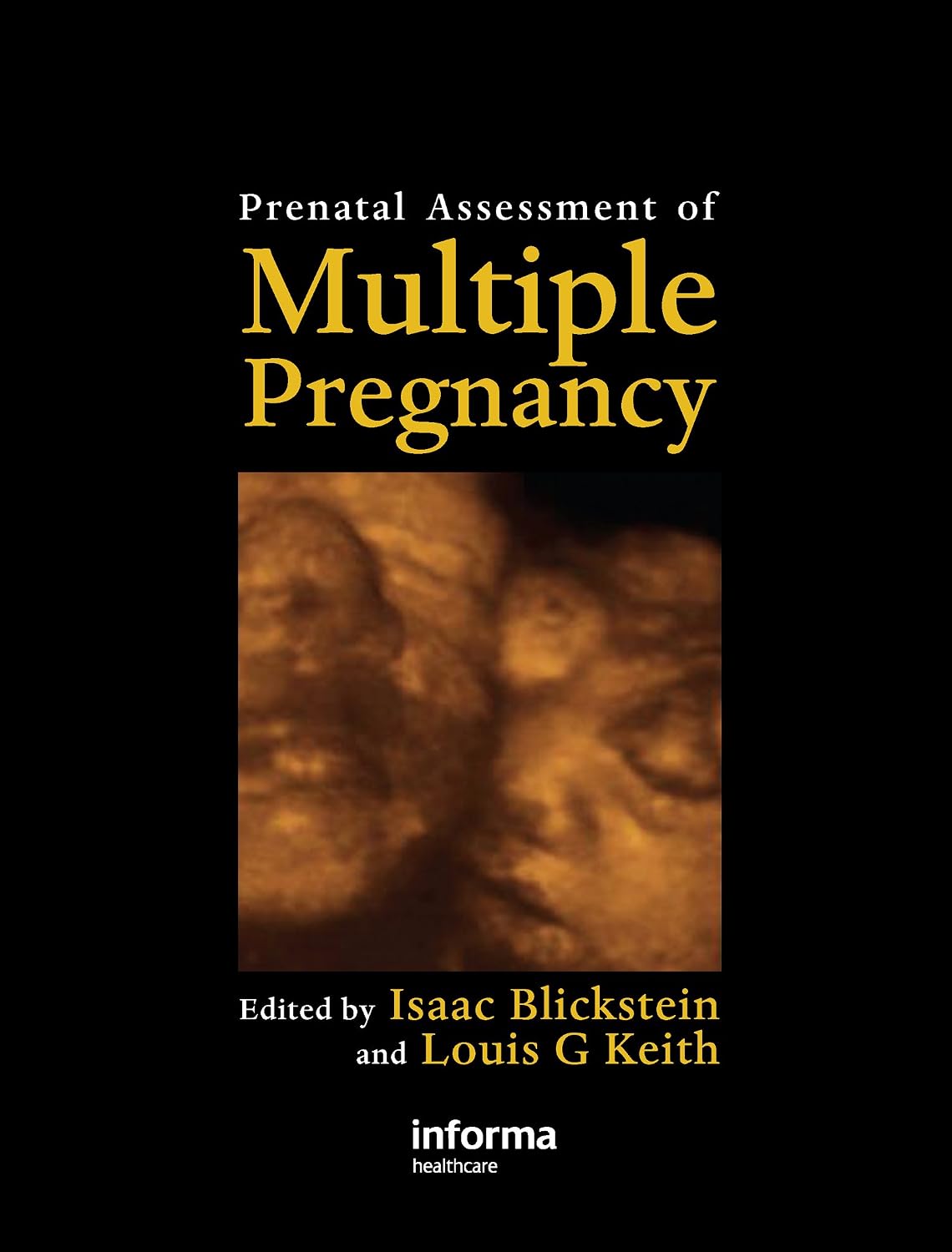 Prenatal Assessment of Multiple Pregnancy      1st Edition, Kindle Edition