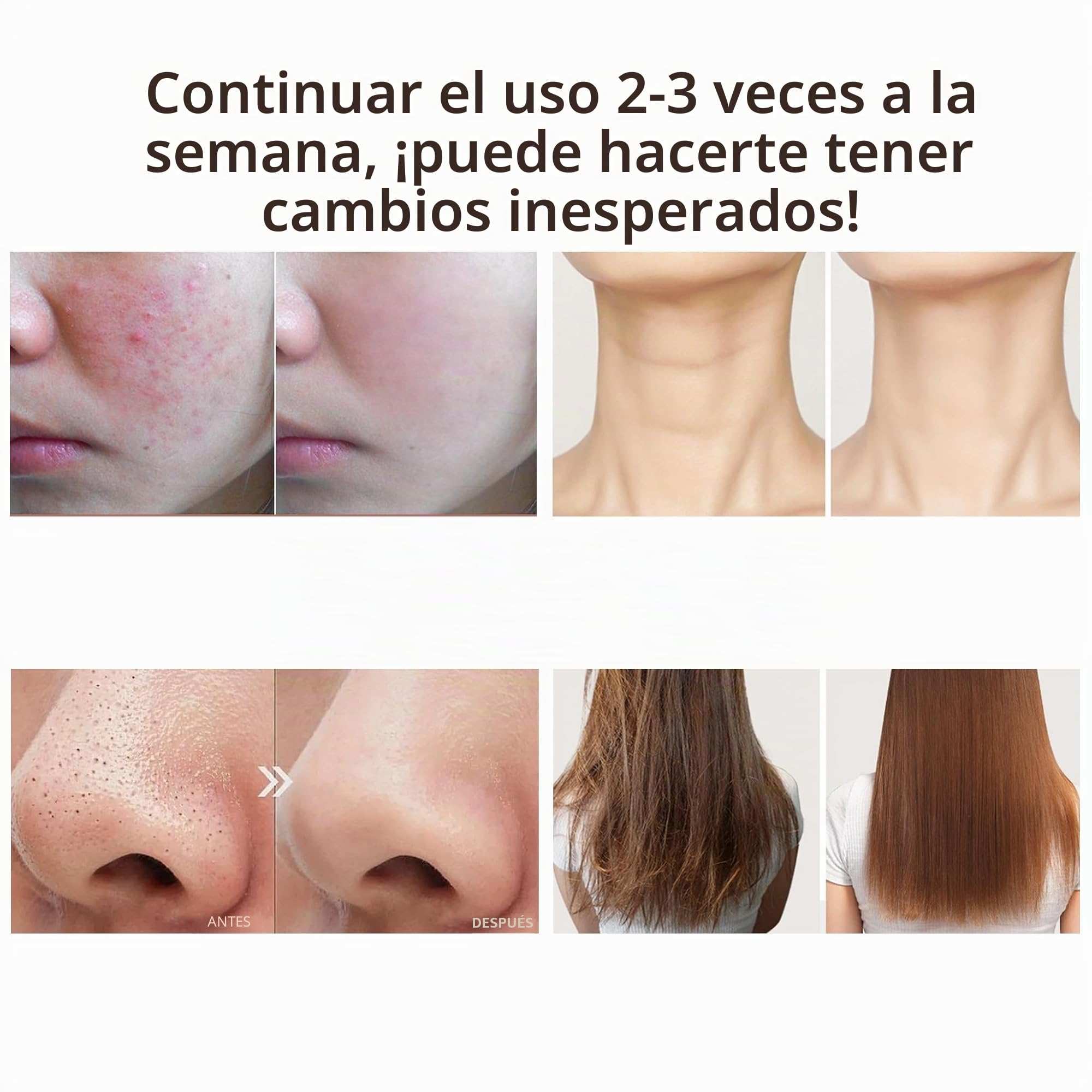 Cara de varilla de alta frecuencia, 6 varillas Hf de alta frecuencia de neón, recta, portátil, de alta frecuencia que aprieta la piel, acné, eliminación de arrugas, ojos hinchados, cuidado corporal