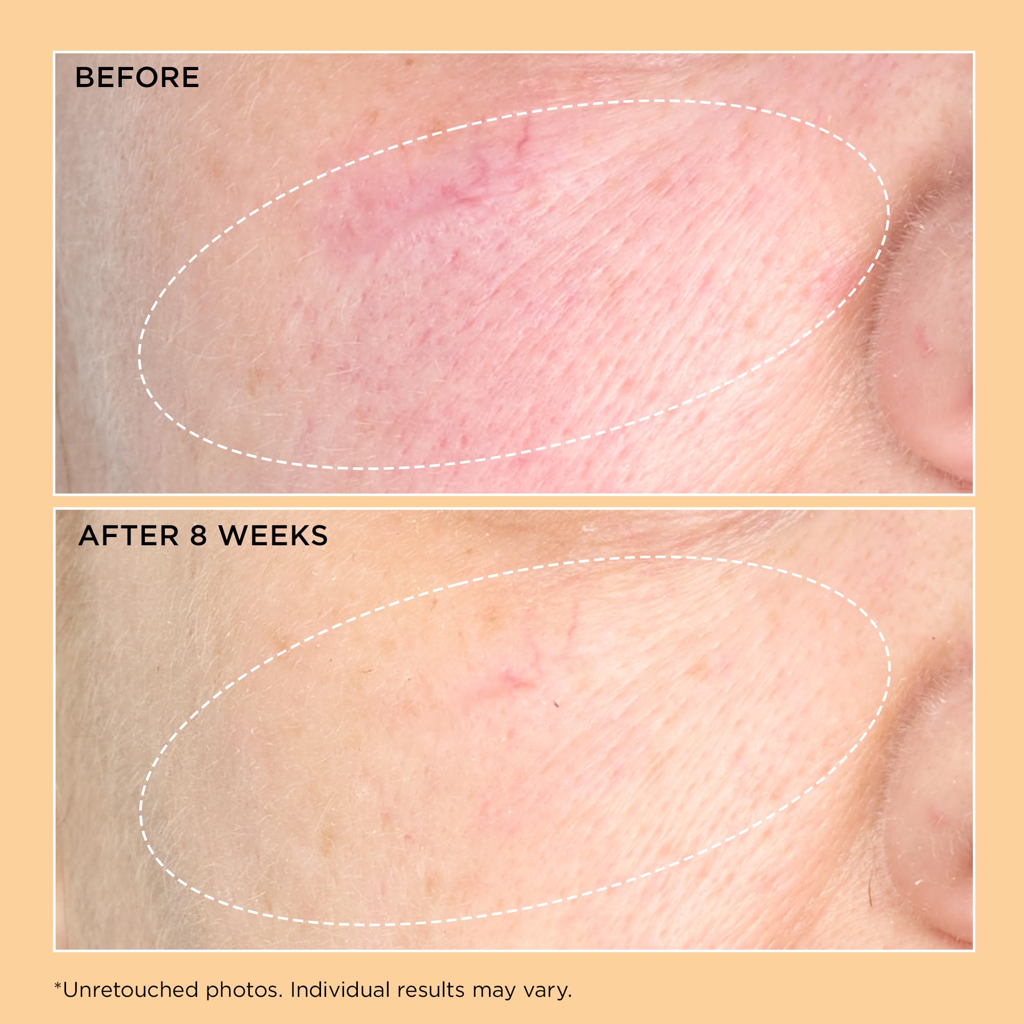 Perricone MD Neuropeptide Pro-Strength Firming Moisturizer, 2 fl oz.