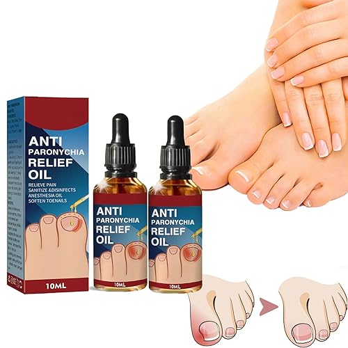 Aceite de alivio de paroniquia, aceite de alivio antiparoniquia, tratamiento de paroniquia para los dedos del pie, aceite de alivio antiparanoquia