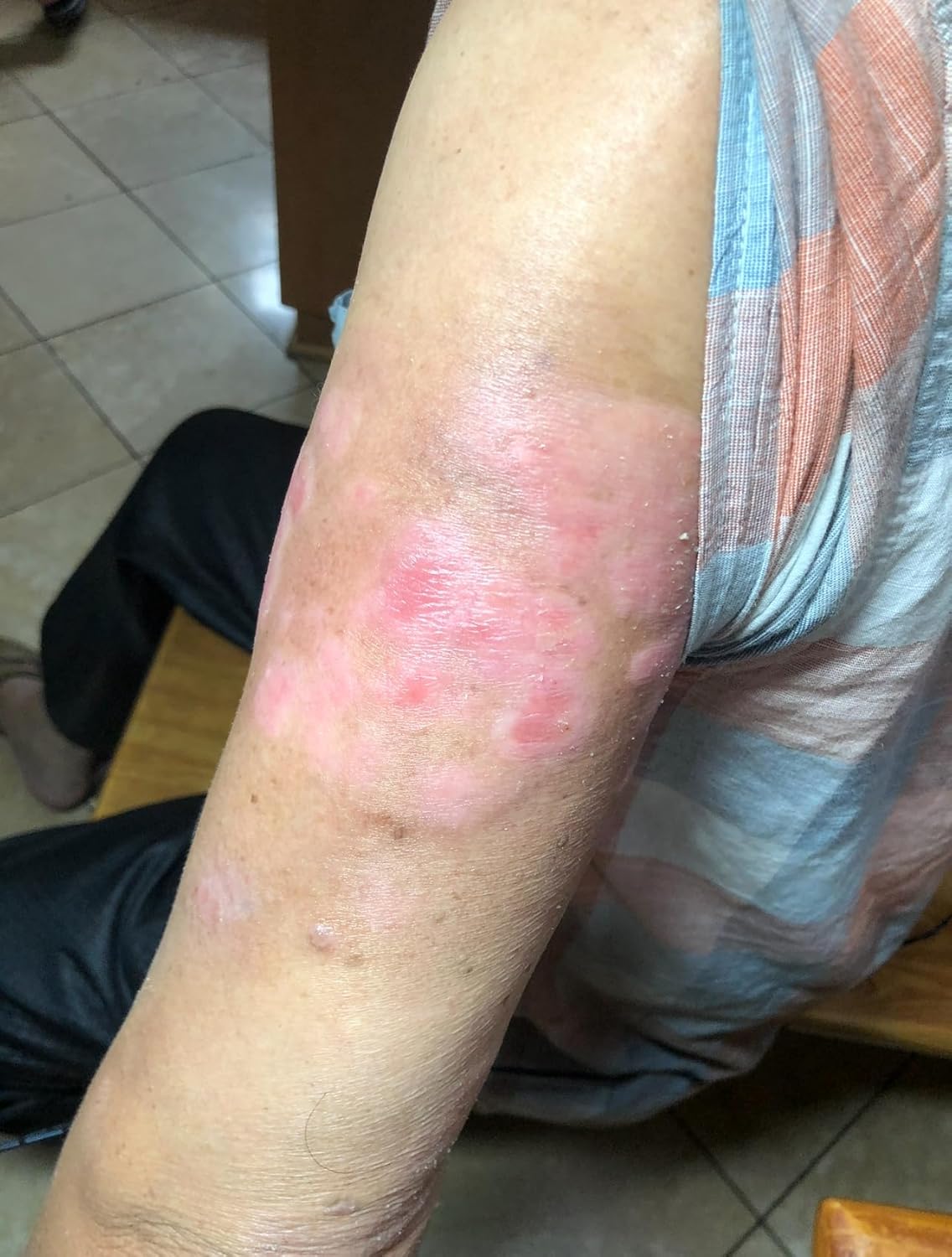 Kawakawa- Pure Healing Balm 0.18 oz (5g) (3) Natural Botanical Skin Balm with ingredients from NZ