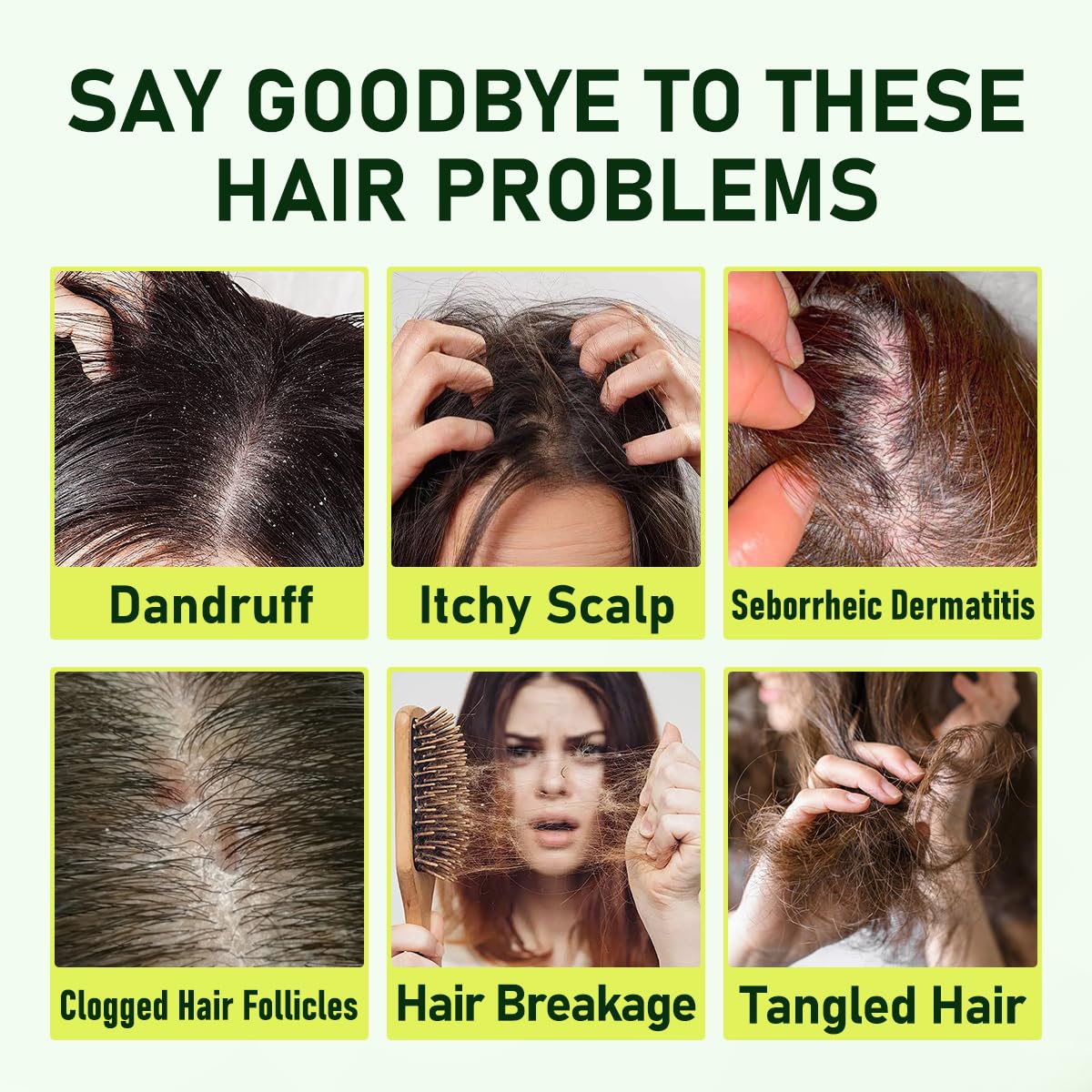 Follicle Shampoo,Anti-Dandruff Shampoo for Men & Women- Helps Relieve Flaking & Itchy Scalp and Dryness, Sulfate & Paraben-Free, 10.14 Fl Oz - Image 3