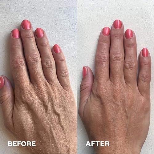 Miniatura 3 de Wrinkles Schminkles Parches antiarrugas para manos, almohadillas de silicona reutilizables para manos deshidratadas, desgastadas y expuestas al sol,