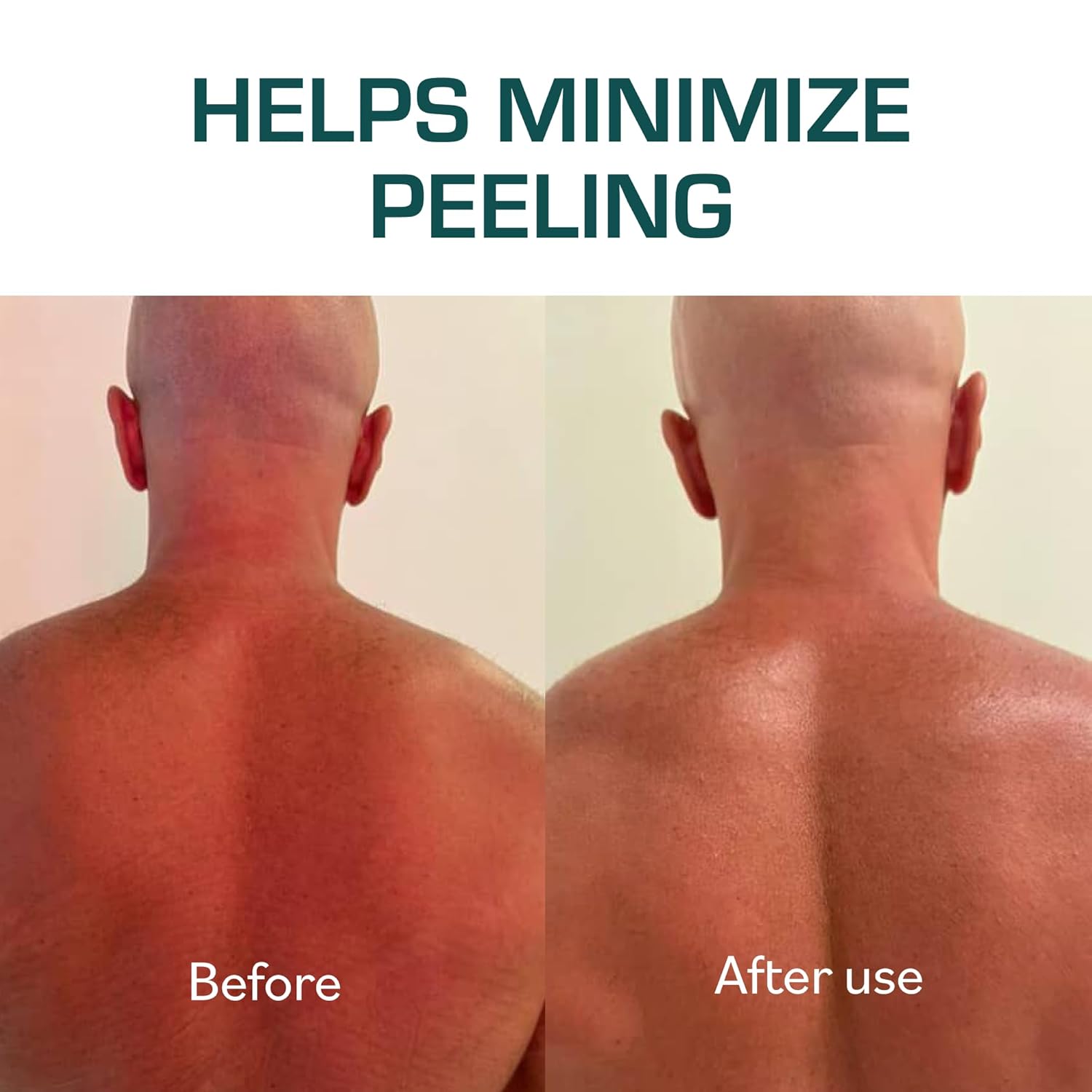 TERNS Mayday Intensive After Sun Gel Cream, Cooling Skin Care for Sunburn Relief, 3X Marine Bioactive Complex with Niacinamide, Squalane, Shea Butter & Aloe, Travel Size, Fragrance Free, 2 Fl Oz