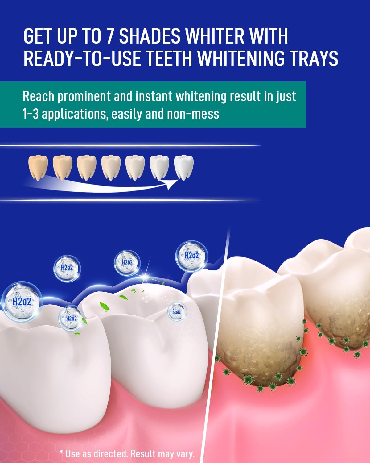 MySmile 7 Treatment Prefilled Teeth Whitening Trays 12% Hydrogen Peroxide and Fluoride Free Nano Hydroxyapatite Toothpaste Combo for Sensitive Teeth Relief, Enamel Repair and Teeth Remineralization