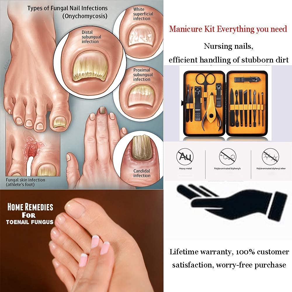 Manicure Set Nail Clipper Set -15 Piece Stainless Steel Nail Care Aids - Finger Nail Clippers,Toenail Clippers -Portable Travel & Grooming Kit Tools (2 Set) : Health & Household