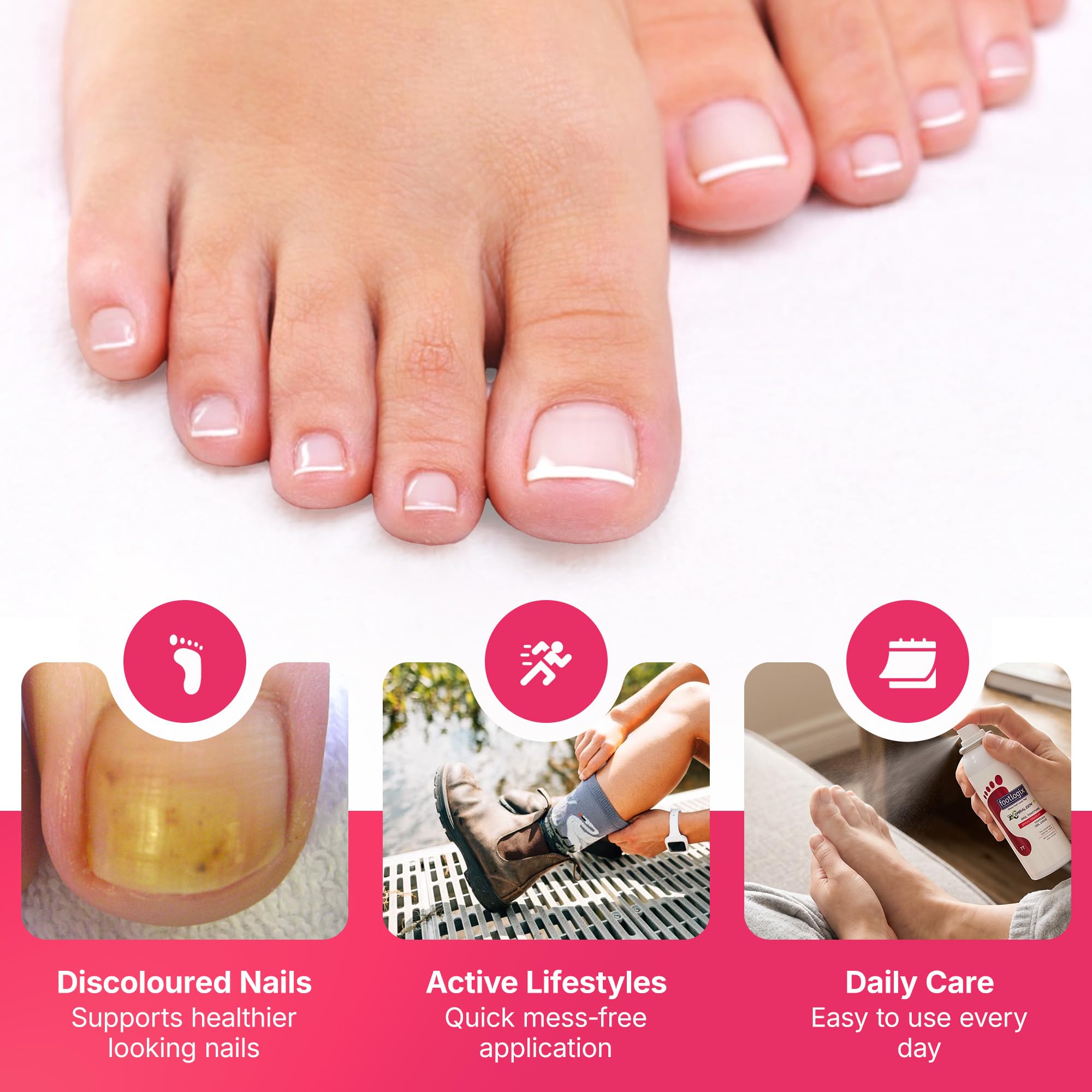 Footlogix Nail Tincture Spray with Spiraleen, Tea Tree Oil & Panthenol