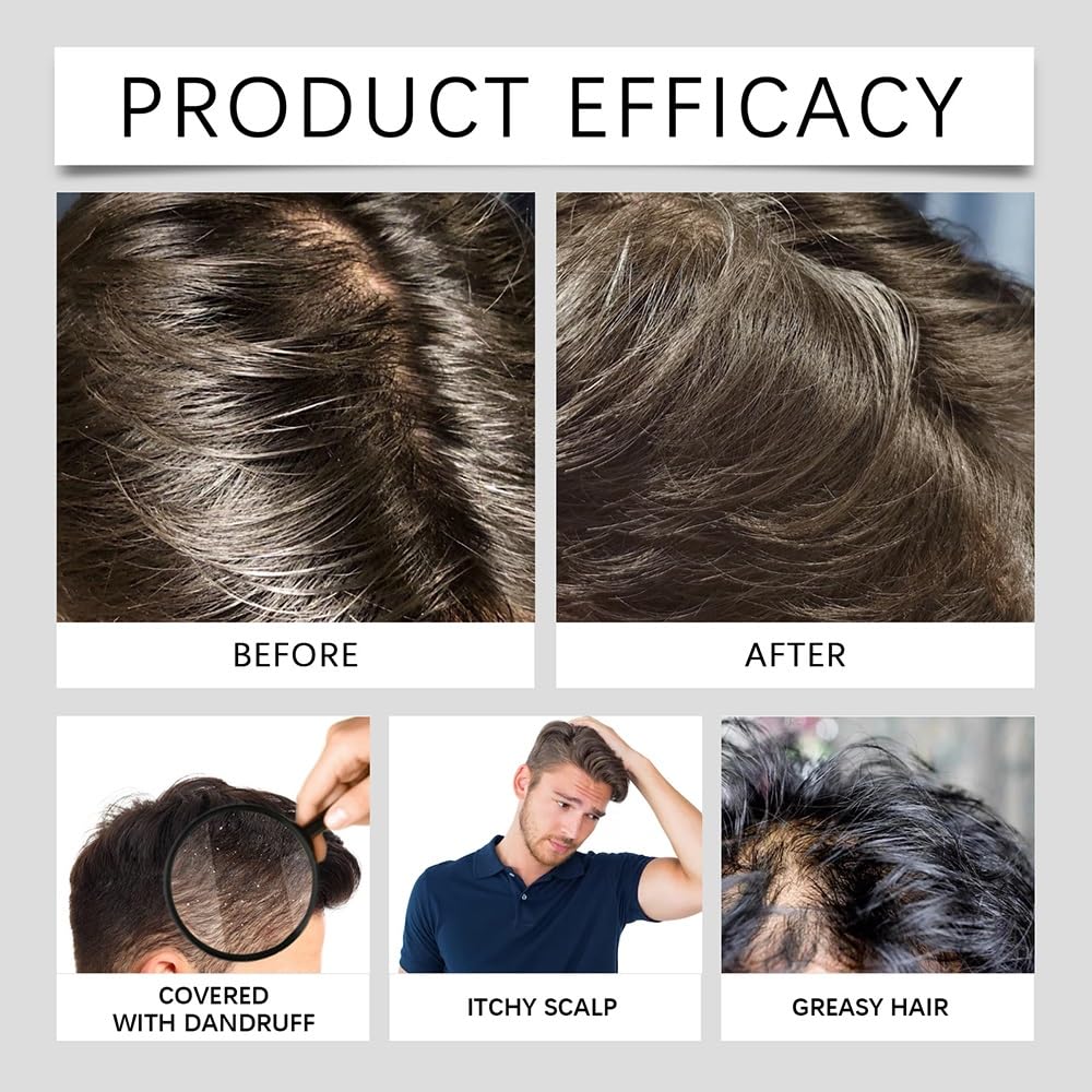 Shampoo lenitivo rinfrescante alla menta, un detergente purificante profondo che controlla l'olio for capelli leggeri e voluminosi