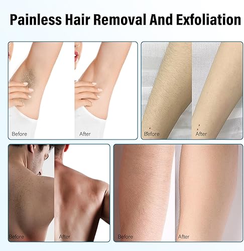 Miniatura 5 de Canvalite Removedor de pelo de cristal para mujeres y hombres, dispositivo de depilación de cristal mágico rápido sin dolor para brazos, piernas,