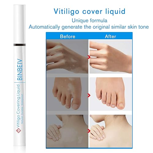 Miniatura 5 de Vitiligo Cosmetic Camouflage Liqui, cubierta apariencia de la despigmentación de la piel, natural, duradero, impermeable, cubierta de maquillaje