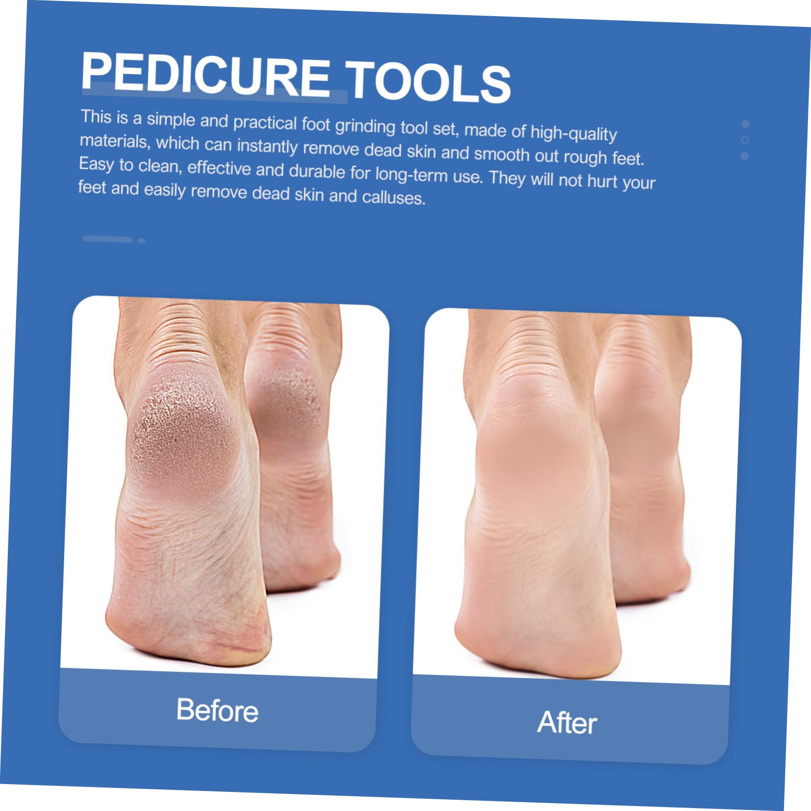 Set di 7 Pezzi per Pedicure in Acciaio Inox, Argento | Acciaio Alto Manganese e Pu, Uso Familiare e Professionale, Rimozione Calli e Pelle Secca