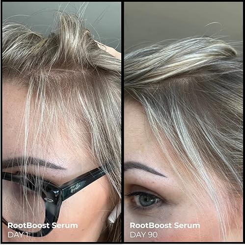 Miniatura 3 de EVOLVh - Suplemento Nutracéutico Complejo RootBoost Better Roots para un crecimiento saludable del cabello | Cuidado del cabello vegano, no tóxico,