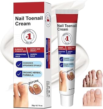 Nail Fungus Treatment Cream   Deep Repair for Toenails & Fingernails, Targets Thick, Yellow, Damaged Nails   Gentle Botanical Formula with Precision Applicator for Daily Use