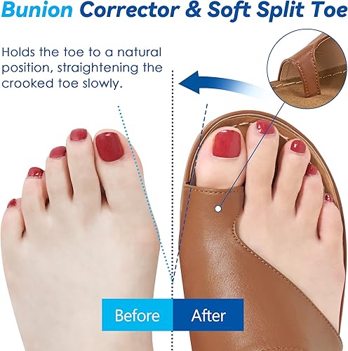 Miniatura 3 de Reimferce Sandalias de cuña para mujer, zapatos con plantilla ortopédica acolchada para juanetes, zapatos de cuña de verano elegantes con punta de