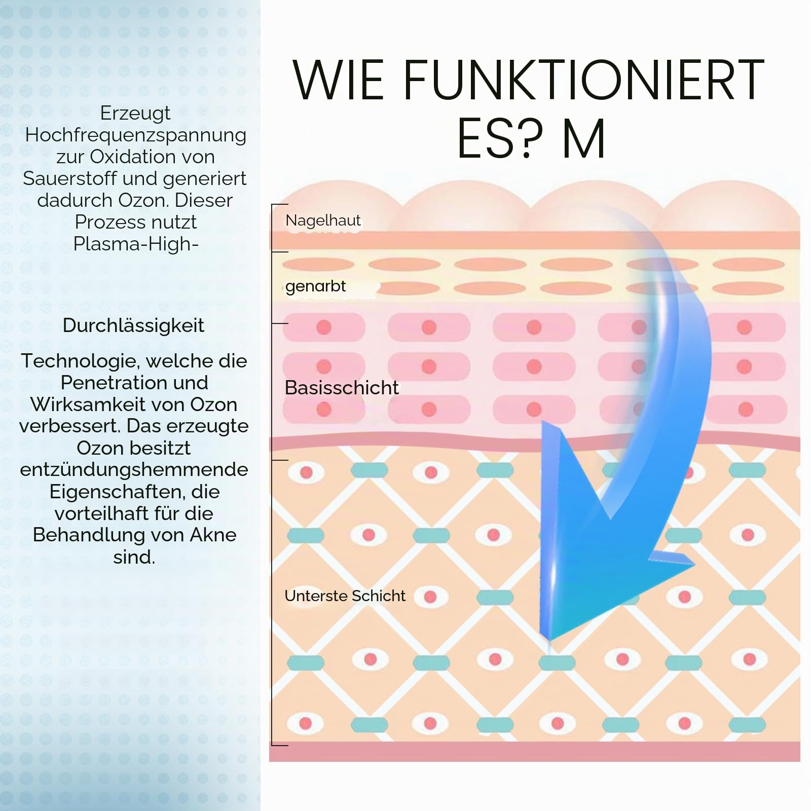 Plasma Pen Professional für Aknebehandlung – Professionelles Hautpflegegerät zur Entfernung von Aknenarben, Porenverfeinerung & Gesichtslifting, Tragbares Beauty-Gerät mit USB-Ladefunktion