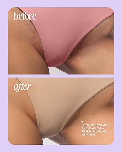 Miniatura 5 de Truly Luxury After Shave Oil  Soothing & Hydrating Treatment to Prevent Ingrown Hair For Smooth, Irritation-Free Skin for Daily Use