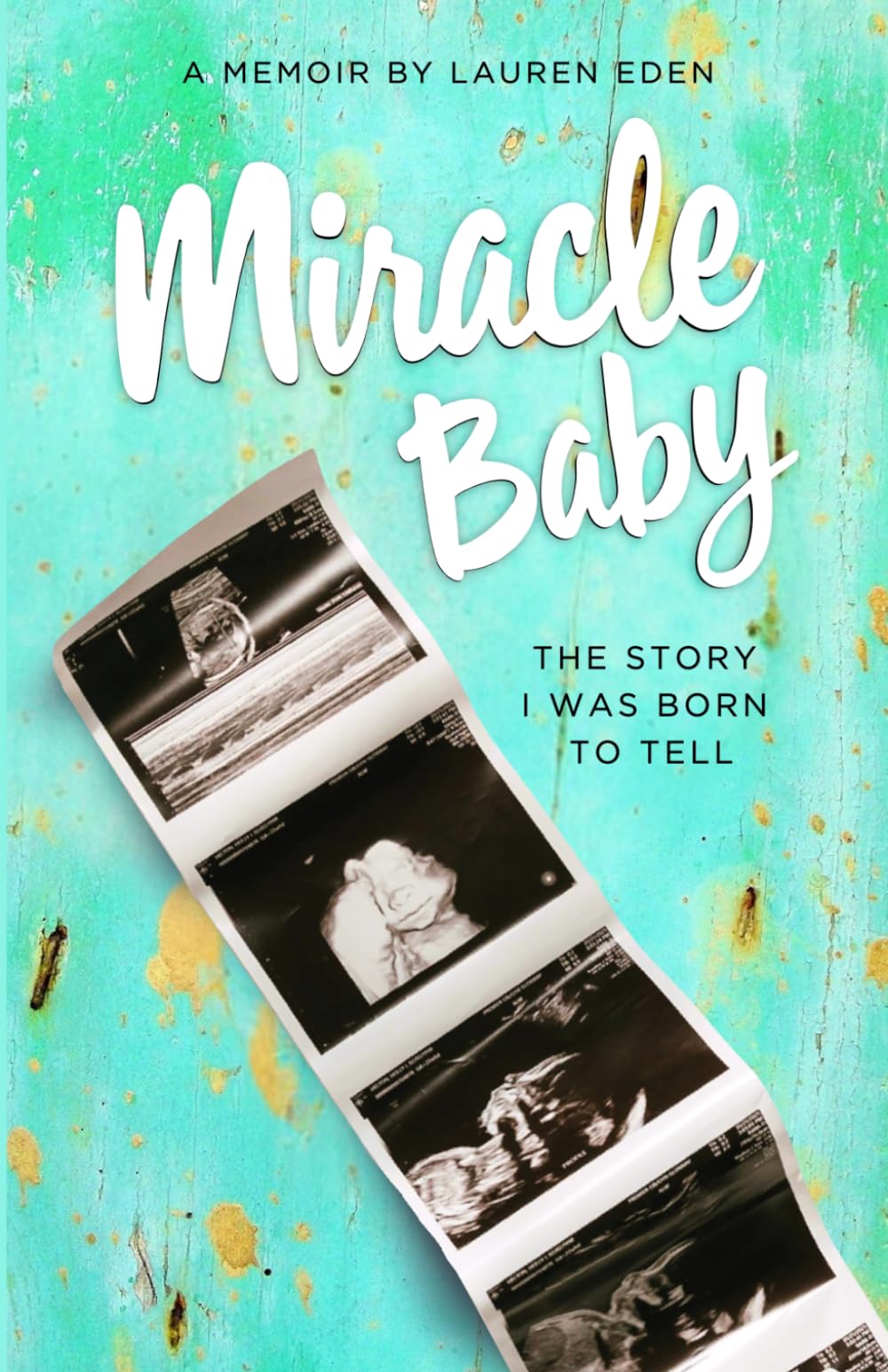 Miracle Baby: The Story I Was Born to Tell: A Journey of Rescue, Redemption, and Calling