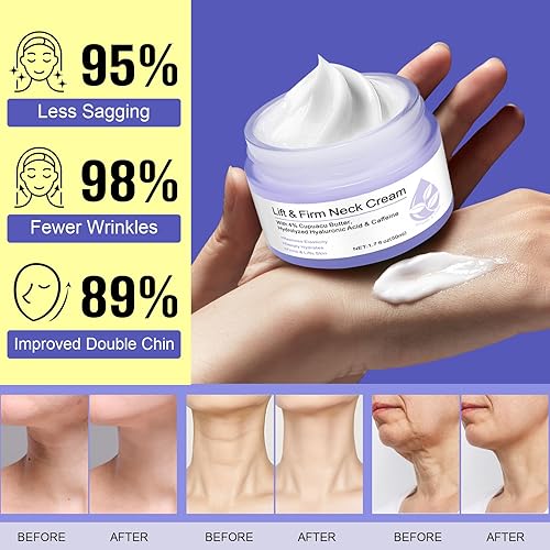 Miniatura 5 de Crema reafirmante para el cuello – 1.7 onzas líquidas – Crema hidratante reafirmante del cuello para líneas finas, piel crepey, crema hidratante