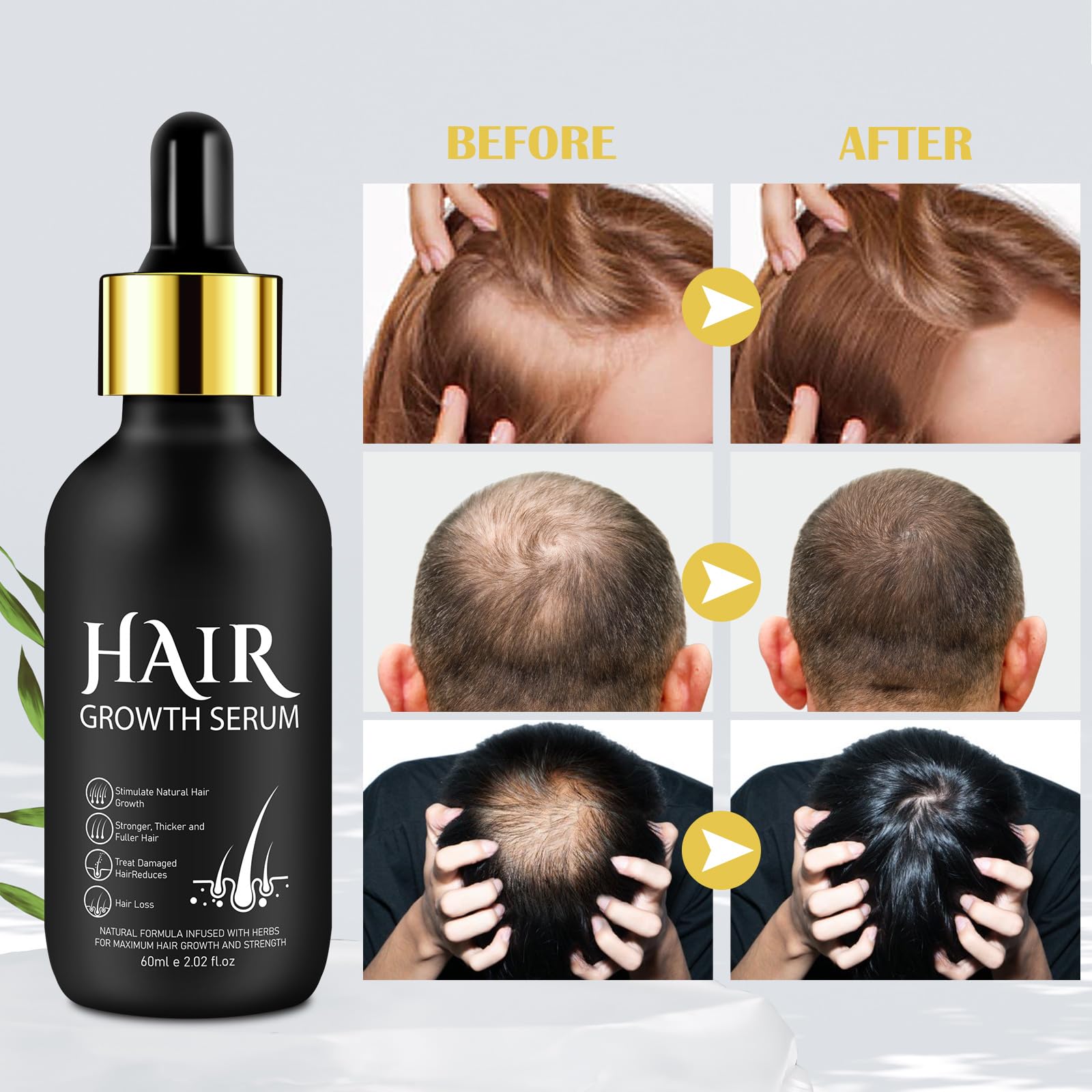 Sérum Capillaire à Micro-aiguilles Pour Cheveux épais - 30 Ml, Formule Renforçante, Neuf